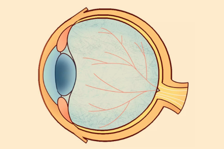4種周邊視網膜變性你知道多少？