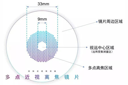 離焦近視控制眼鏡多少錢？一次講明白