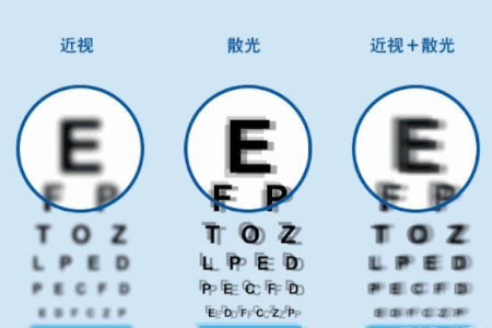 近視300度散光100度相當于近視多少度？